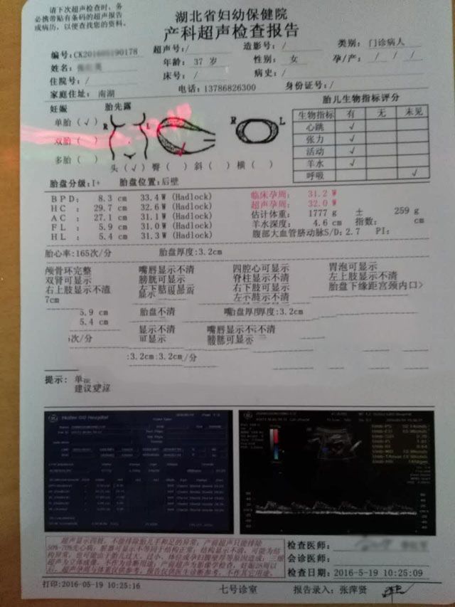 ���ݴ���
