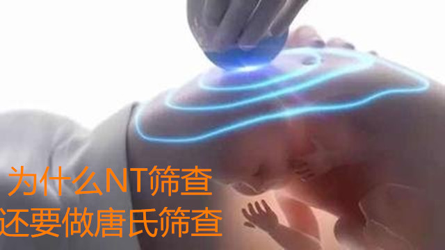  ΪʲôNTɸ�黹Ҫ������ɸ��