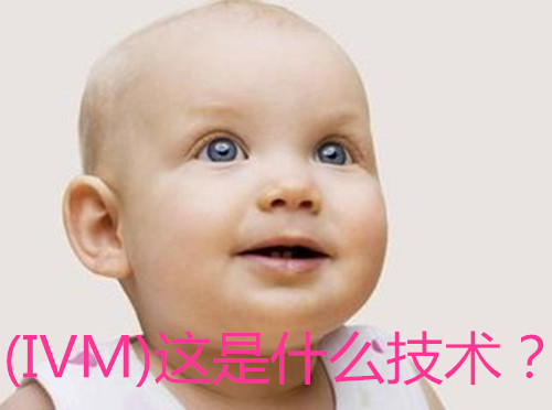 (IVM)����ʲô������